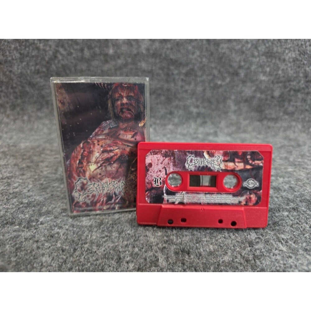 CEPHALOTRIPSY - Uterovaginal Insertion of Extirpated Anomalies 2020 Cassette